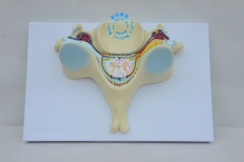 Nemokamas pristatymas&Penkta gimdos kaklelio stuburo modelis su medulla spinalis ir Stuburo nervų amplifikacija medicinos , žmogaus kaulų modelį.