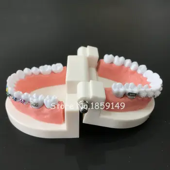1pc Dantų Ortodontinis Gydymas Modelis Su Orto Metalo Keramikos Laikiklis Arch Vielos Burnos Vamzdelis Ligatura Ryšius
