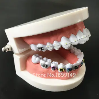 1pc Dantų Ortodontinis Gydymas Modelis Su Orto Metalo Keramikos Laikiklis Arch Vielos Burnos Vamzdelis Ligatura Ryšius