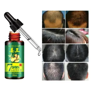 7 Dieną Imbieras Germinaciniai Serumas Aliejus Natūralių Plaukų Slinkimas Treatement Efektyvią Greito Augimo Plaukų Priežiūrai 30ML
